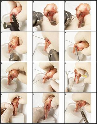 Biomechanical evaluation of a fixation technique with a modified hemicerclage for tibial tuberosity transposition: an ex vivo cadaveric study